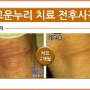 고운누리피부과의원 이미지