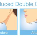 스펀지성형외과의원 이미지