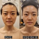 스킨&바디 퀸