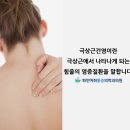 삼성역정형외과 극상근건염 증상과 원인 이미지