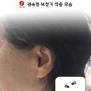 독일보청기 이미지