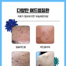 홍천한의원 네이버블로그