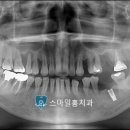 스마일홍치과의원 이미지