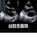 수성하트내과의원 이미지