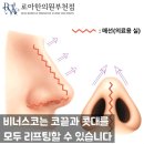 로아한의원 비너스코 예쁜 코 만드는 비법 2가지 공개