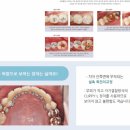 손고운치과의원 네이버블로그