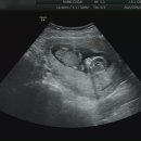 정성일산부인과의원 이미지