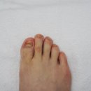 화곡로68길 | 마곡 문제성발톱 안 아프게 해결! 가양역내성발톱무좀 김수정 뷰티 가양역점 후기