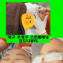 모드니헤어라인