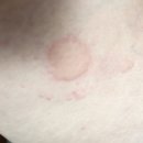 이화사랑피부과의원 이미지