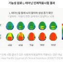 긴장 손떨림 어떻게 해야할까? 이미지