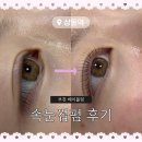 지에스25원미늘푸른점 | 상동속눈썹 잘하는곳 해이블링, 숱없는 속눈썹 J컬 속눈썹펌 비포애프터 후기