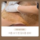 여름 노출 전 필수 관리 | 의정부 스킨스토리 알라딘필링 등 관리 후기