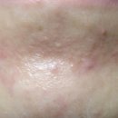 채널플러스의원 이미지