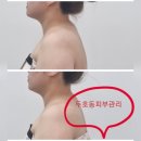 밸루스 | 포항북구피부관리 벨루스에스테틱 솔직후기