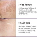 닥터프리메틱 기미미백크림 후기 | 일양약품 약국템으로 부모님 선물 추천