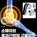 소3-9 | 소웨이브 구름깔창 | 발바닥 통증 때문에 써본 족저근막염 운동화 깔창 후기 추천