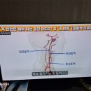 폐렴 원인및 예방법 이미지