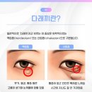 샘소아 네이버블로그