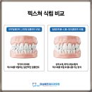 이-프란트치과 이미지