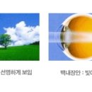 송탄하나안과의원 이미지