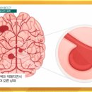 메디캐치정형외과의원 네이버블로그