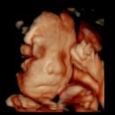 B.L 치과기공소 | 프롬프트 l 임당검사 후기 임당 통과 l 부가부 디럭스 폭스5 당근 구매 l b형간염 접종 l 임산부 충치 치료