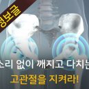 [건강] 소리없이 깨지고 다치는 고관절을 지켜라 이미지