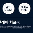 세라믹치과기공소 이미지