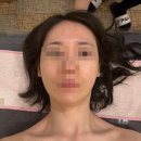 동탄피부샵ㅣ바쿠나 DD무통증 관리 후기. 수앤미에스테틱