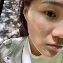 셀리즈피부과의원 | 마린시티 피부과 추천 | 스킨부스터+리프팅 한번에 가능한 더블타이트 시술 후기