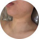 유경화장품 | [안양피부관리] 얼굴비대칭, 이중턱에 짧은 목으로 스트레스 받는 얼굴형 "엘가비에스테틱" 윤곽관리로...