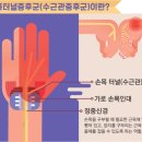 손목터널증후군이나 손목건초염이 있는지 간단하게 확인하는 방법 이미지