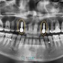 으뜸치과기공소 이미지