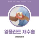 청량리임플란트추천 재수술은 왜 필요할까요?