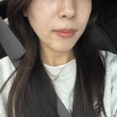 튠스타트 | 이수역 피부과 튠페이스 후기