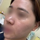뉴본 스킨케어