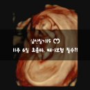 임신일기15 ෆ 임신 11주 6일차 초음파 │ 태아보험 다이렉트 가입 사이트