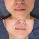 보금뷰티 | 내돈내산/군산 피부관리/동안관리 윤곽관리/보금뷰티 후기/웨딩케어/신부관리