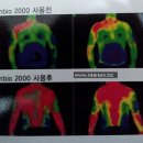 1도의 기적, 체온1도가 내 몸을 살린다. 심부주열요법 이미지