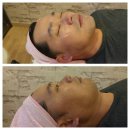 아리따운피부 이미지