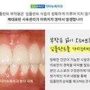 보강치과기공소 이미지