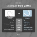 서울대학교직장부속치과의원 | 인비절라인 통증 후기, 환자들이 가장 많이 하는 질문!
