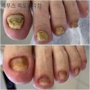 레푸스목포