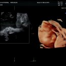 빵빵한 하루 | [임신일기#33] 재택+출장+빵빵한 하루의 콜라보 27주차 임산부 일상