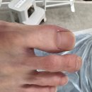 레푸스 앤 두두뷰티 | 의정부 두꺼운발톱 고민? 레푸스 앤 두두뷰티에서 해결!
