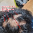 바로스탑한의원 이미지