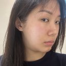 유니프라임 | 울쎄라프라임 300샷 30살 한달 차 생생후기