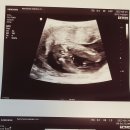 양수1여자 이미지