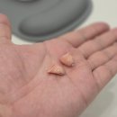 스타키보청기 춘천난청센터 | 춘천보청기 스타키보청기 춘천난청센터에서 체계적인 난청 관리